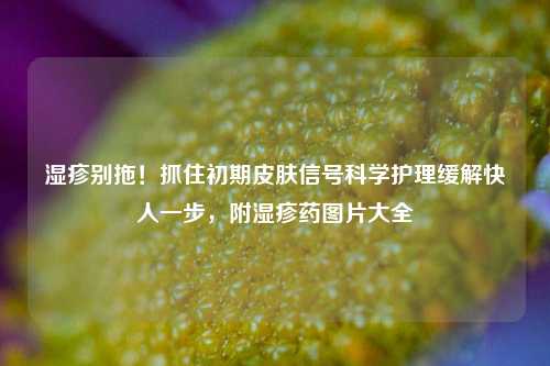 湿疹别拖!抓住初期皮肤信号科学护理缓解快人一步,附湿疹药图片大全